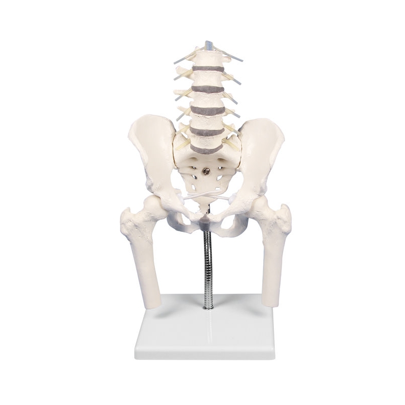 Lumbarna hrbtenica z medenico za prikaz nepravilnega položaja