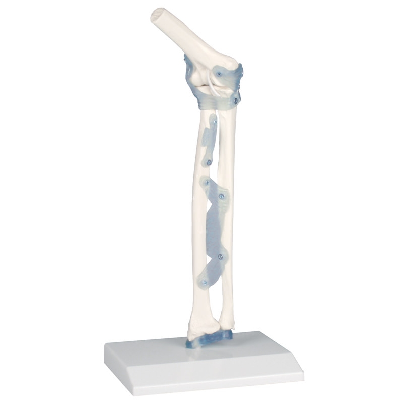 Komolčni sklep z vezmi na stojalu