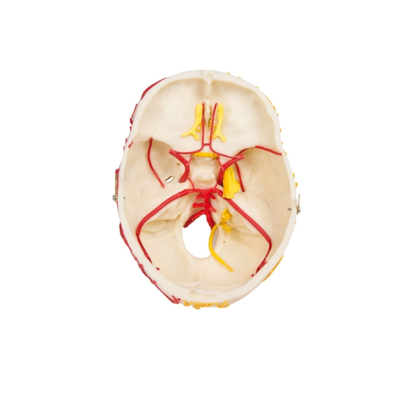 Nevrovaskularna lobanja z možgani