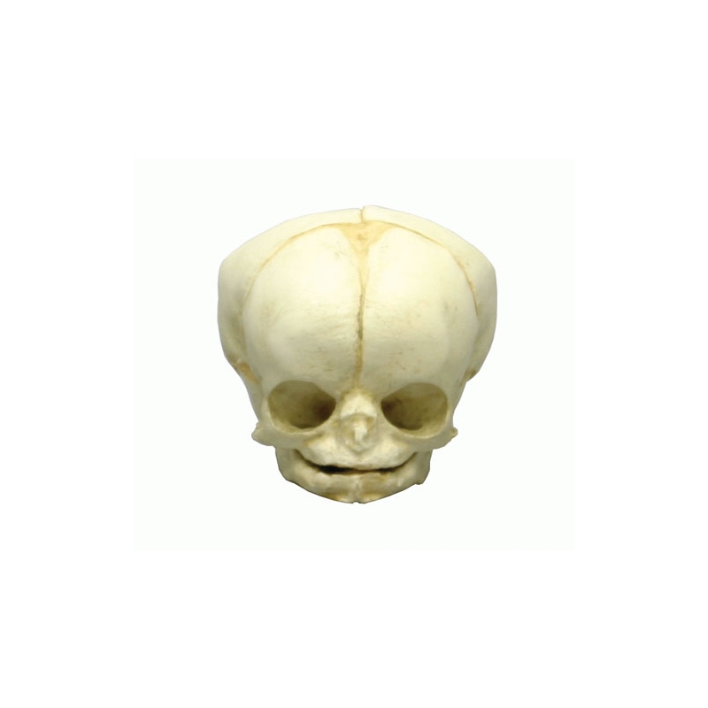 Fetalna lobanja 35 tednov