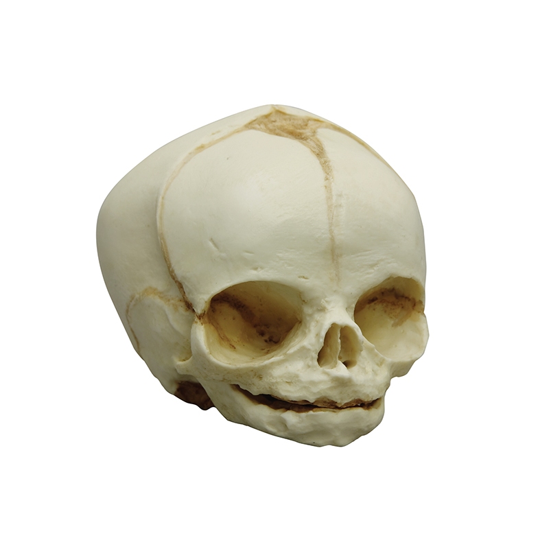 Fetalna lobanja 31 tednov