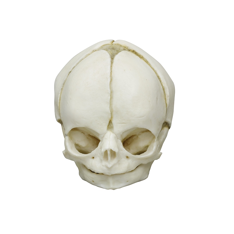 Fetalna lobanja 29 tednov