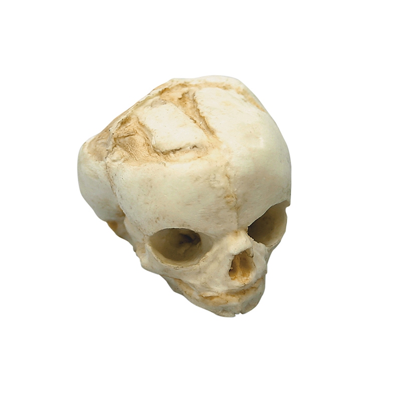 Fetalna lobanja 17 tednov