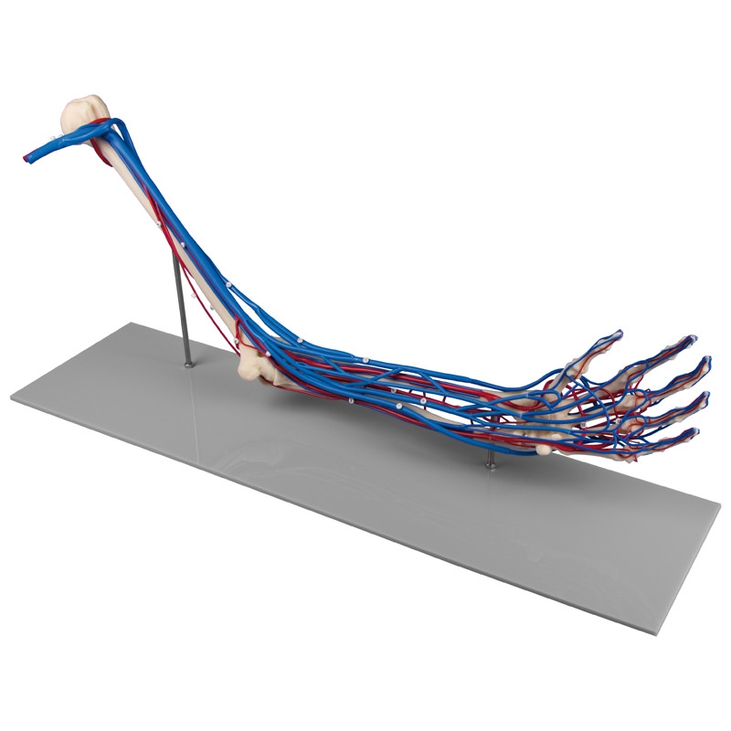 Skelet roke z ožiljem