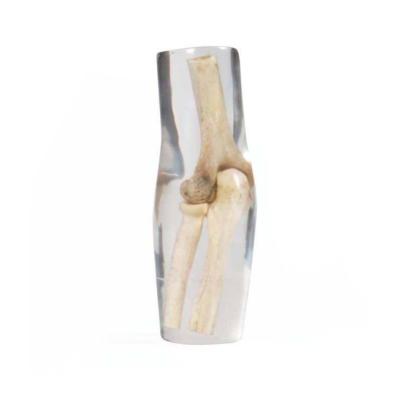 Rentgenski fantomski komolec, prozoren