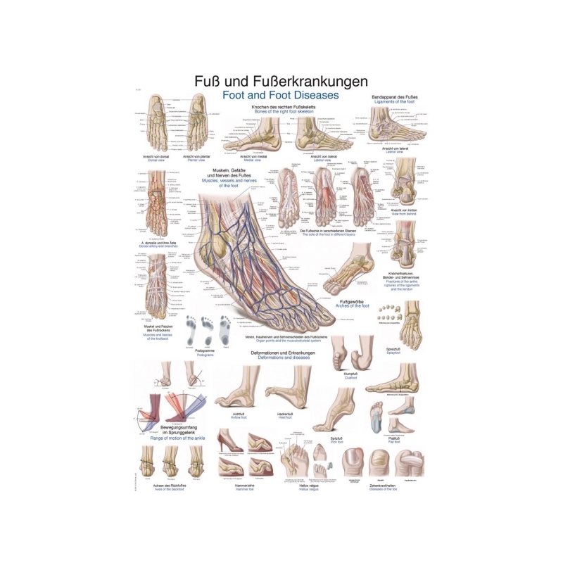 Graf Bolezni stopal in stopal, 50x70cm (Angleško)