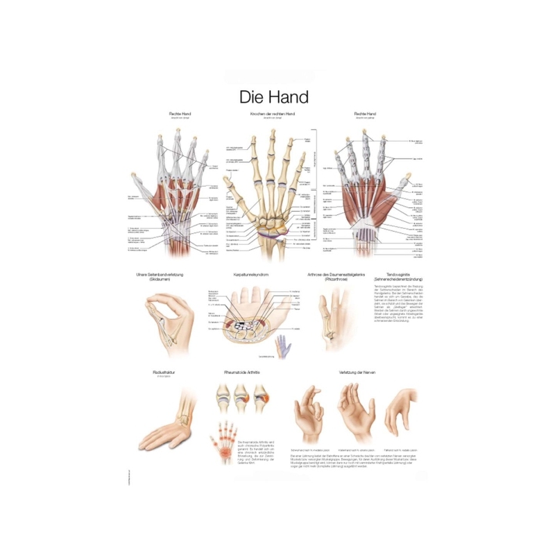 Diagram Roka, 50x70cm (Angleško)