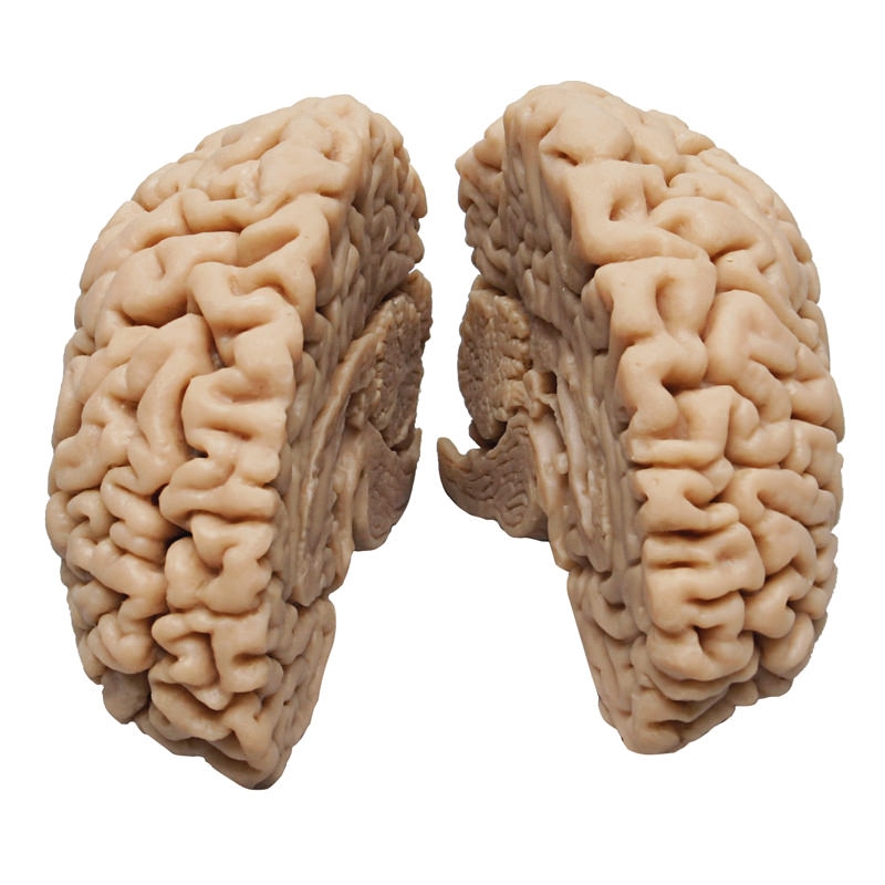 Človeški možgani, dejanski odlitek