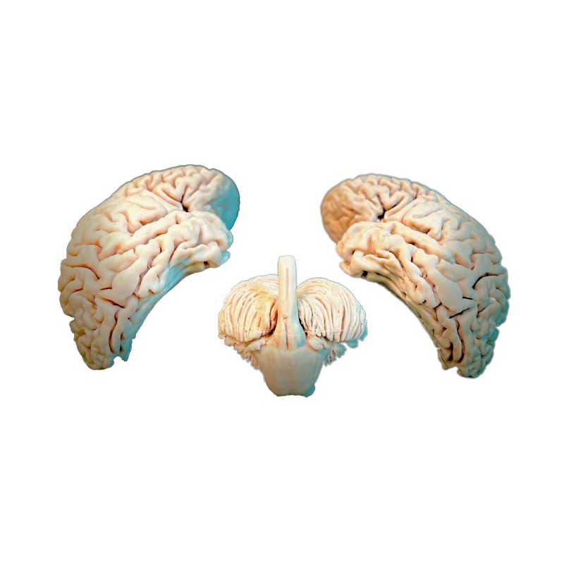 Možgani, 3 kosi