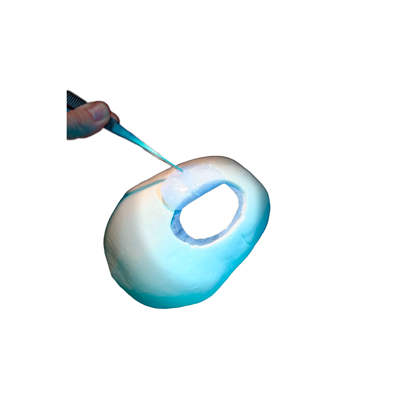 Odprtine z luknjami Calvarium