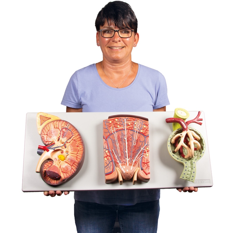 Razdelek ledvic z ledvičnim nefronom in ledvičnim telescem