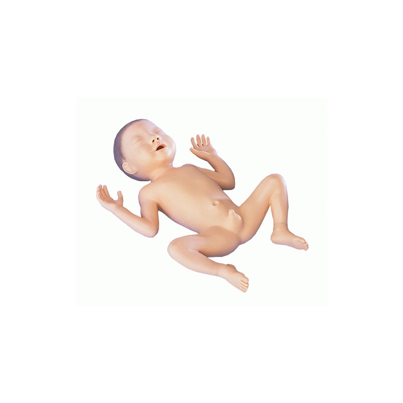 Model nedonošenčka, 30 tednov star deček