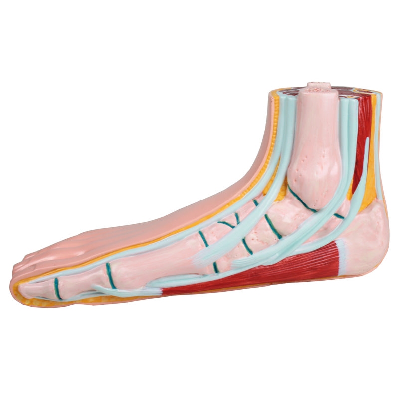 Ploščato stopalo, pes planus