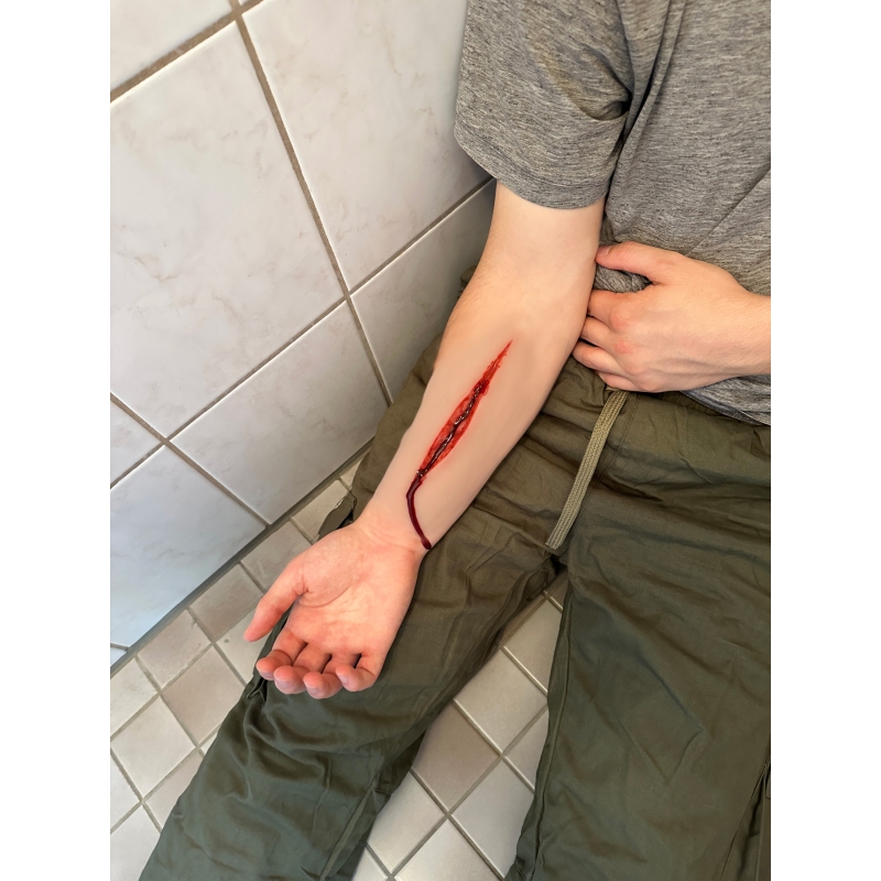 Mulaža rane Poskus samomora