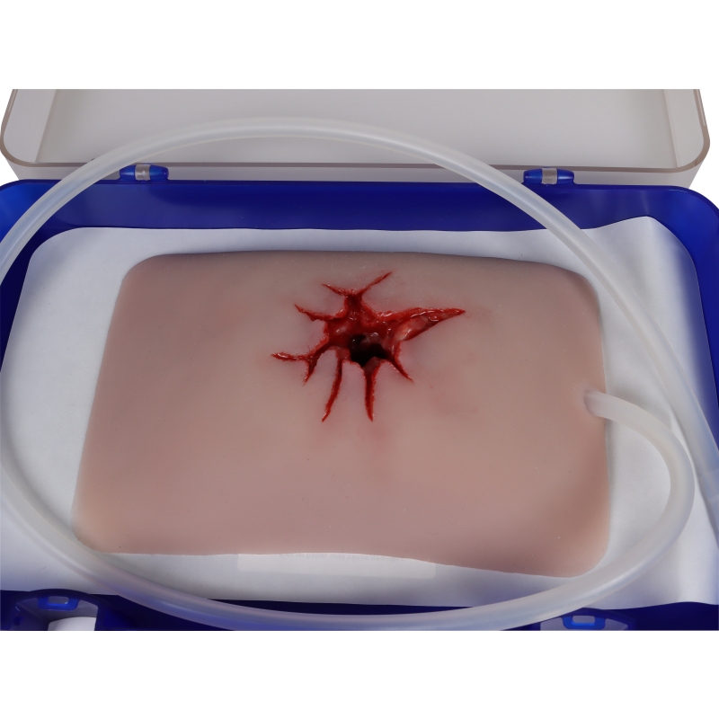 Mulaža rane, strel v dimlje, povijanje rane