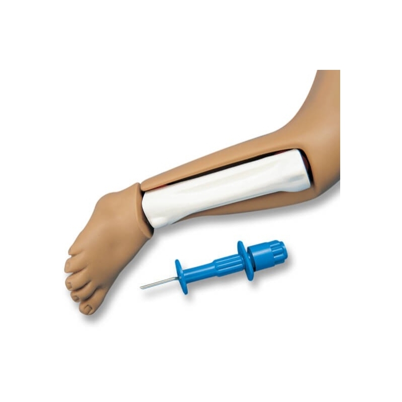 Intraosalna noga za R17700