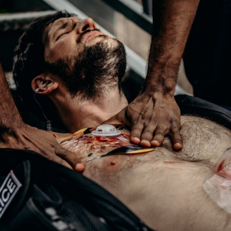 SAM CHEST SEAL Combo – obliž za pnevmotoraks (2 kom. – z ventilom in brez)