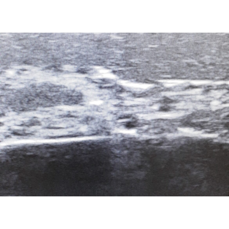 Ultrazvočni trenažer, obraz