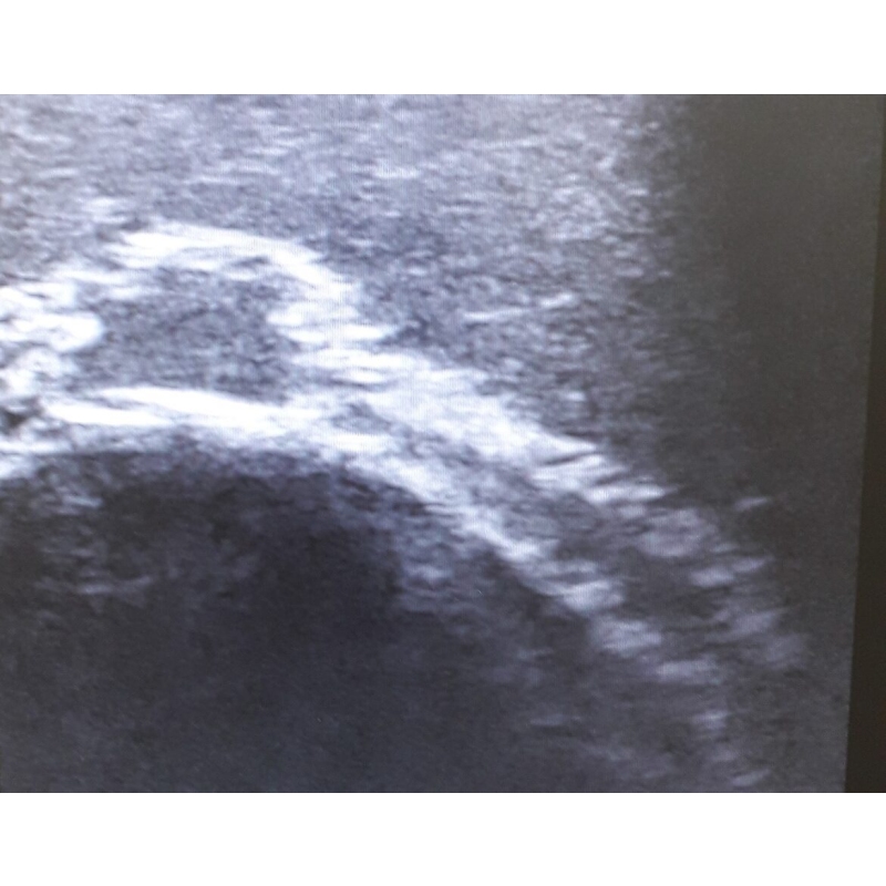 Ultrazvočni trenažer, obraz