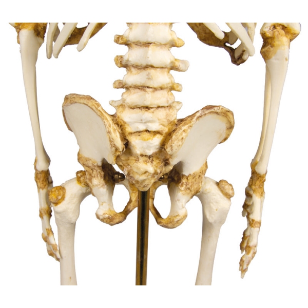 Okostje otroka, 14 do 16 mesecev