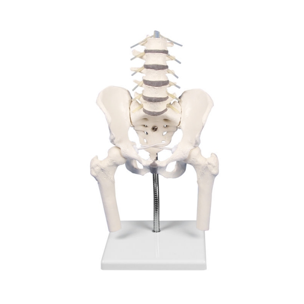 Lumbarna hrbtenica z medenico za prikaz nepravilnega položaja