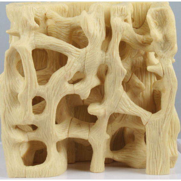 Primerjalni model strukture zdrave / osteoporozne kosti