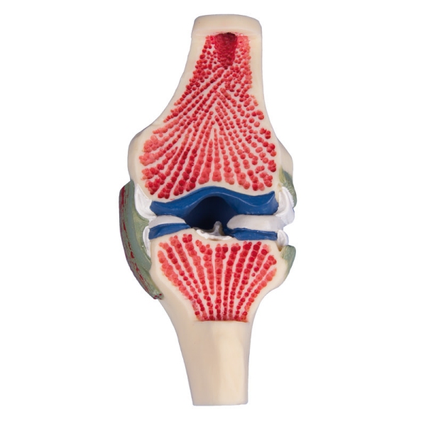 Vzdolžni prerez - model kolena