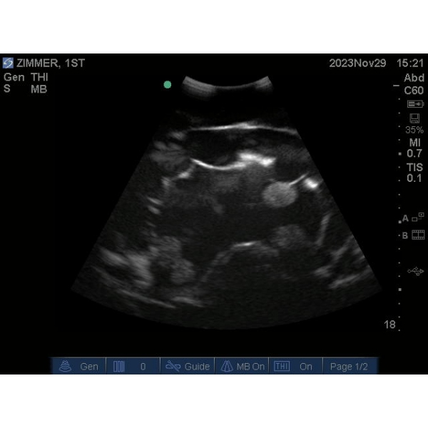 "Echo Eddie" Napredni simulator ultrazvočnega pregleda