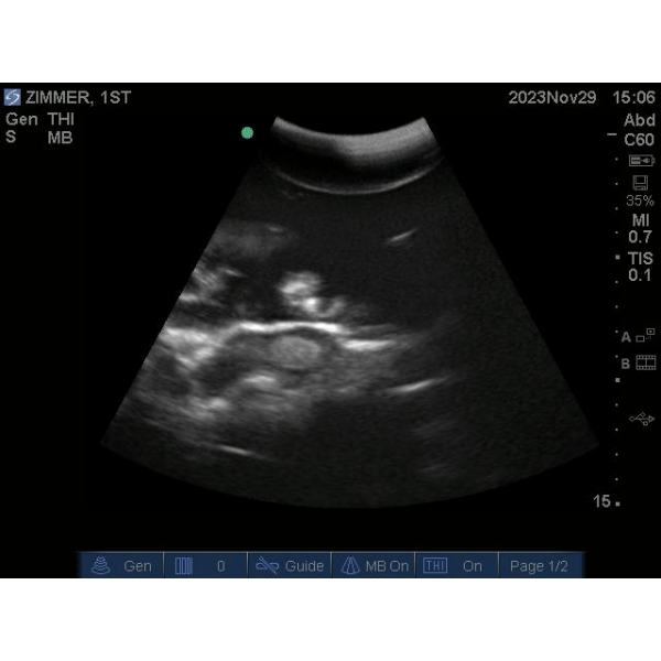 "Echo Eddie" Napredni simulator ultrazvočnega pregleda