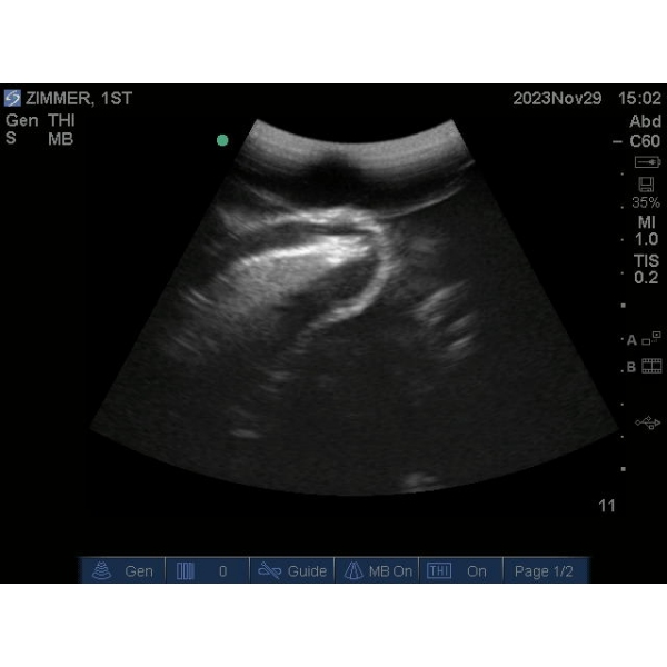 "Echo Eddie" Napredni simulator ultrazvočnega pregleda