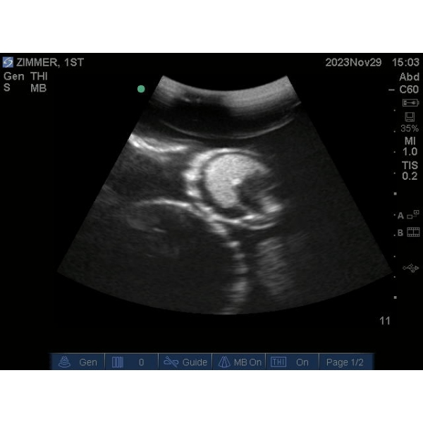 "Echo Eddie" Napredni simulator ultrazvočnega pregleda