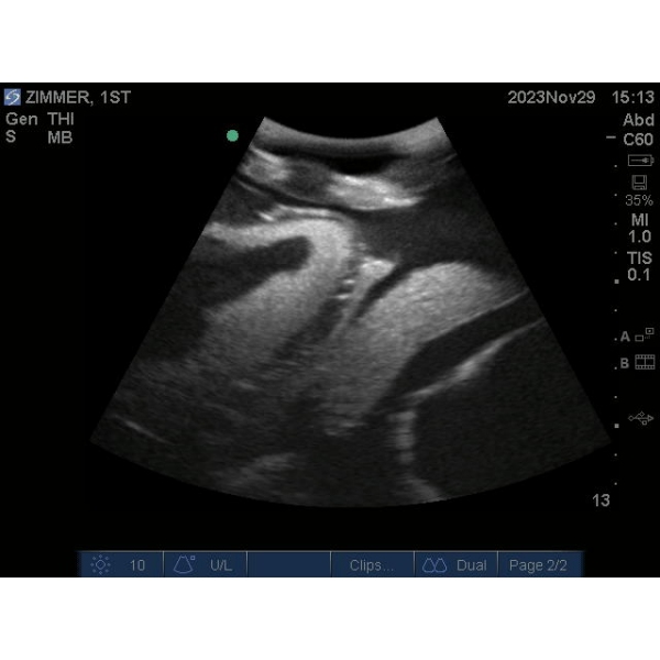 "Echo Eddie" Napredni simulator ultrazvočnega pregleda