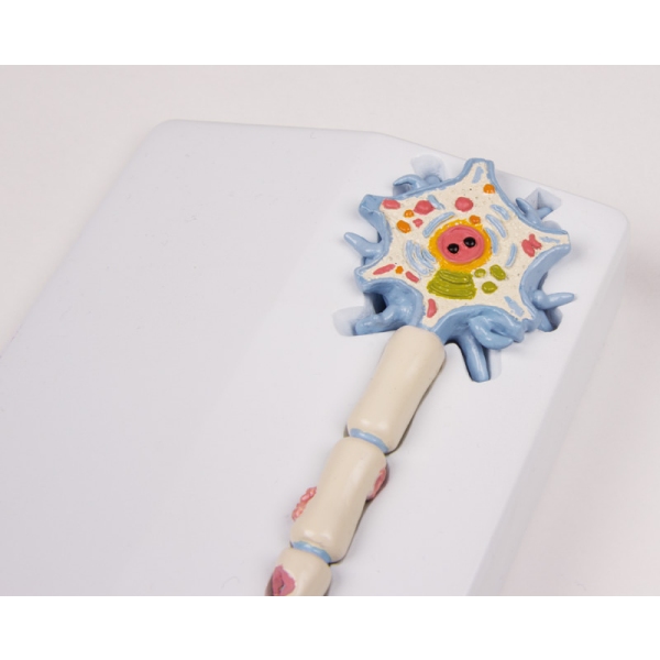 Neuron model with stages of multiple sclerosis - EZ Augmented Anatomy