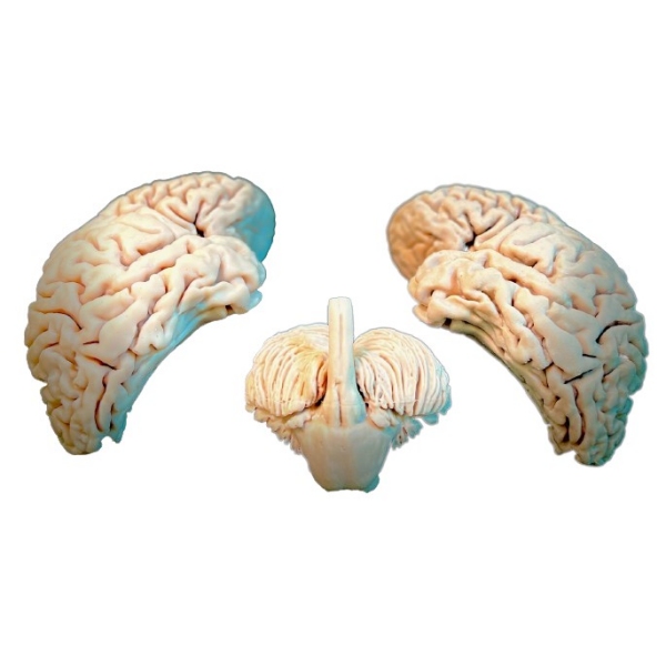 Možgani, 3 kosi