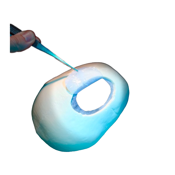 Odprtine z luknjami Calvarium