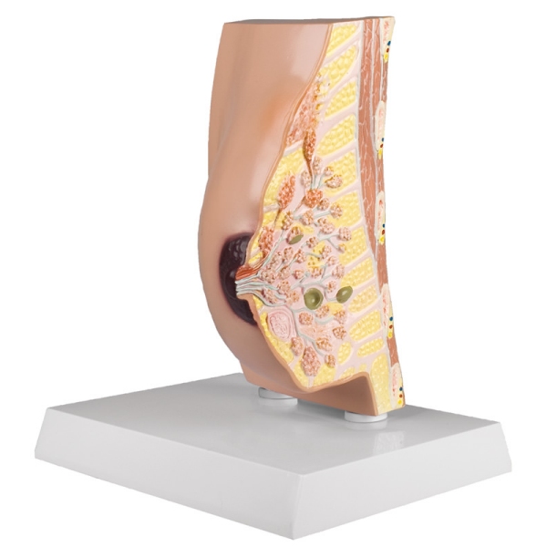 Prerez dojke z boleznimi