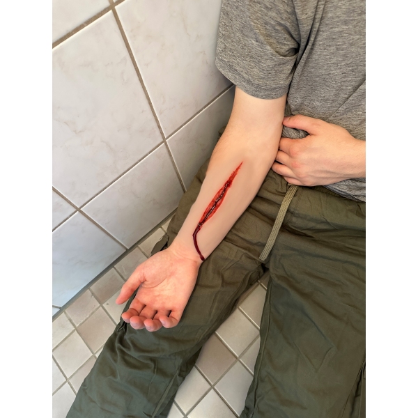 Mulaža rane Poskus samomora