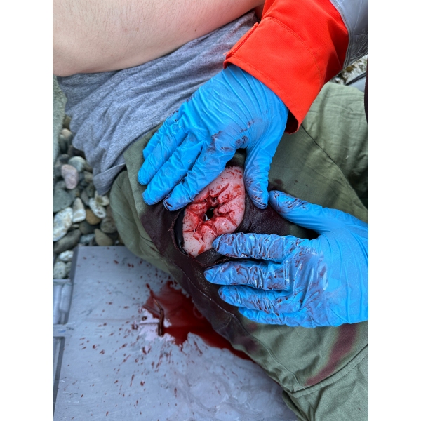 Mulaža rane, strel v dimlje, povijanje rane