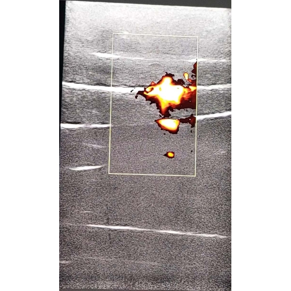 Simulator ravnine Fascia