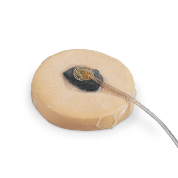 Trenerji za terapijo ran z negativnim tlakom (NPWT)