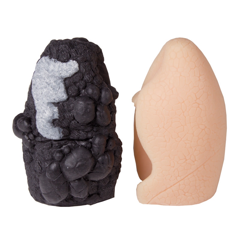 Primerjalni model pljučnega raka