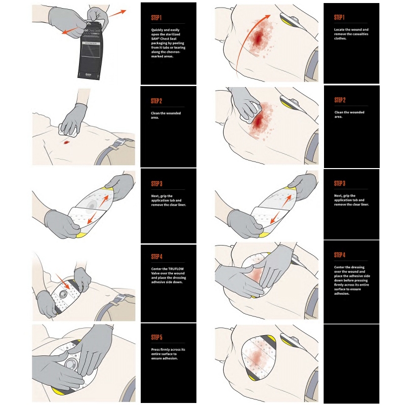 SAM CHEST SEAL Combo – obliž za pnevmotoraks (2 kom. – z ventilom in brez)