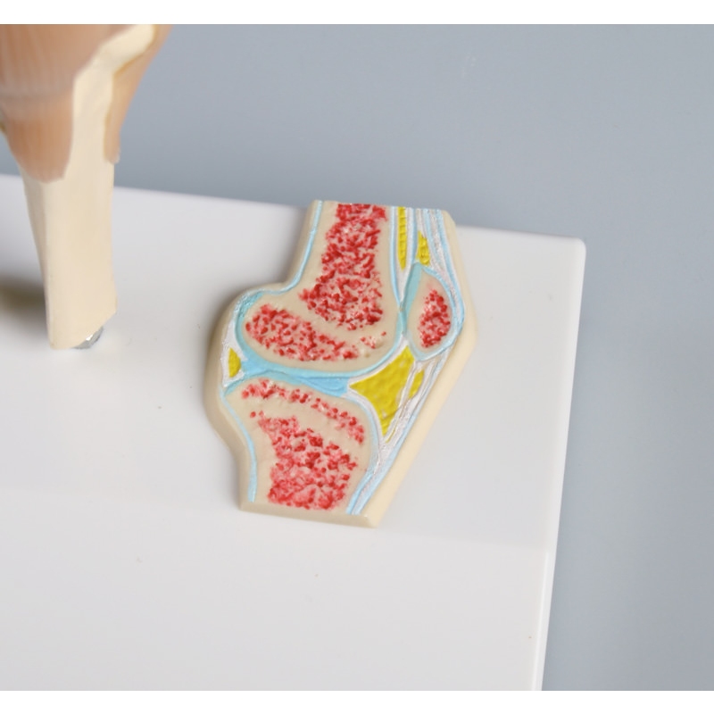 Miniaturni kolenski sklep s prečnim prerezom