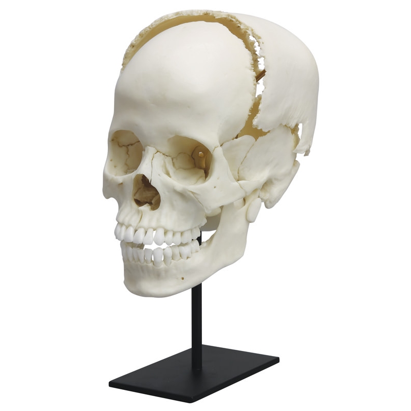 Človeška medicinska študija lobanje