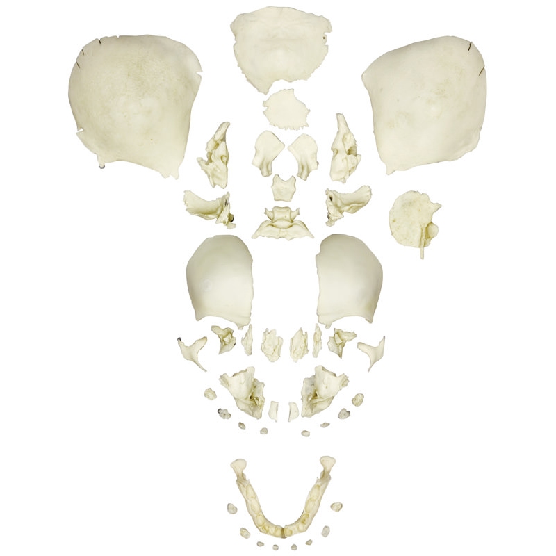 Disartikulirana človeška fetalna lobanja, v polnem rodnem obdobju
