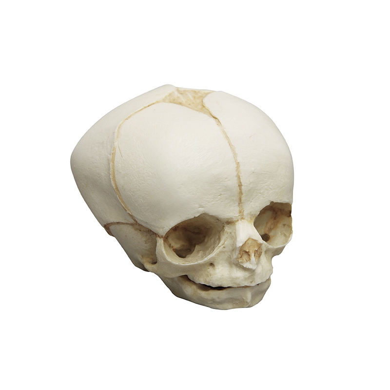 Fetalna lobanja 30 tednov