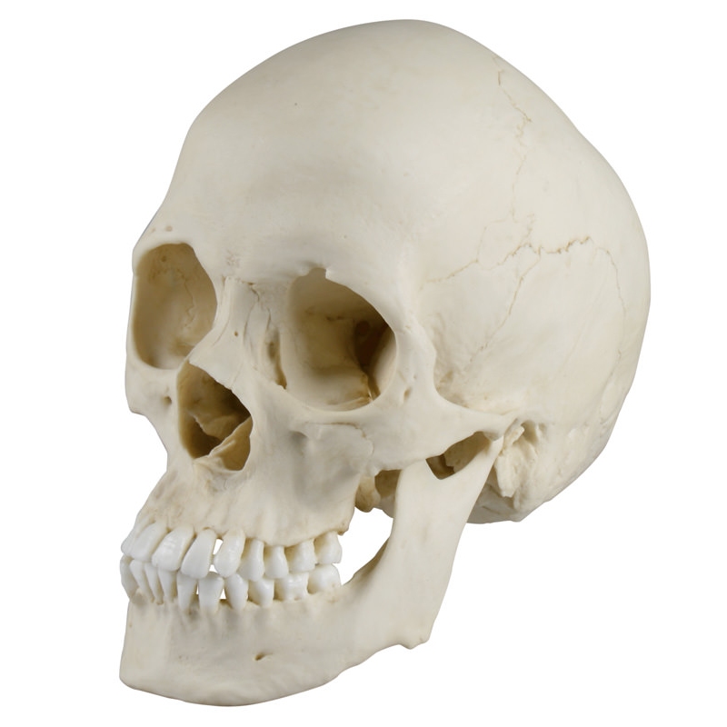 Skafocefalična lobanja