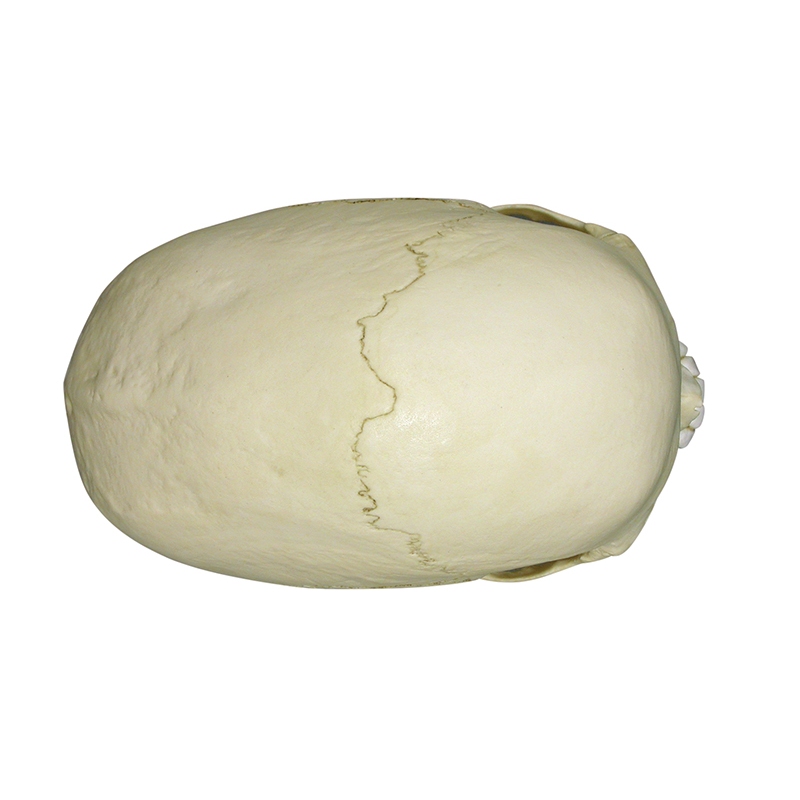 Skafocefalična lobanja