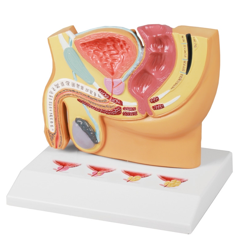 Sekcija moške medenice s PBH