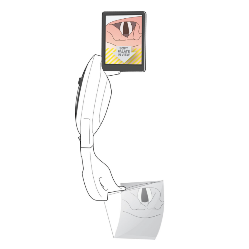 McGRATH MAC Video Laryngoskop Gen 3 (videolaringoskop)